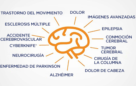 Diagrama del cerebro de neurociencia