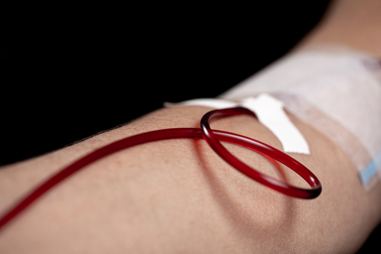 lipoprotein aphoresis procedure