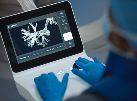 Ion pulmonologist at controller.