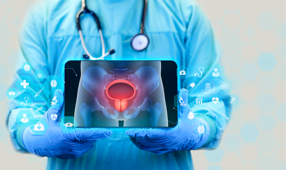 A surgeon holding a bladder image